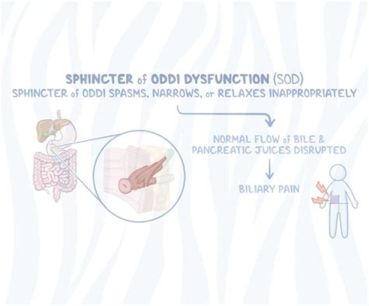 How long do sphincter of Oddi attacks last?