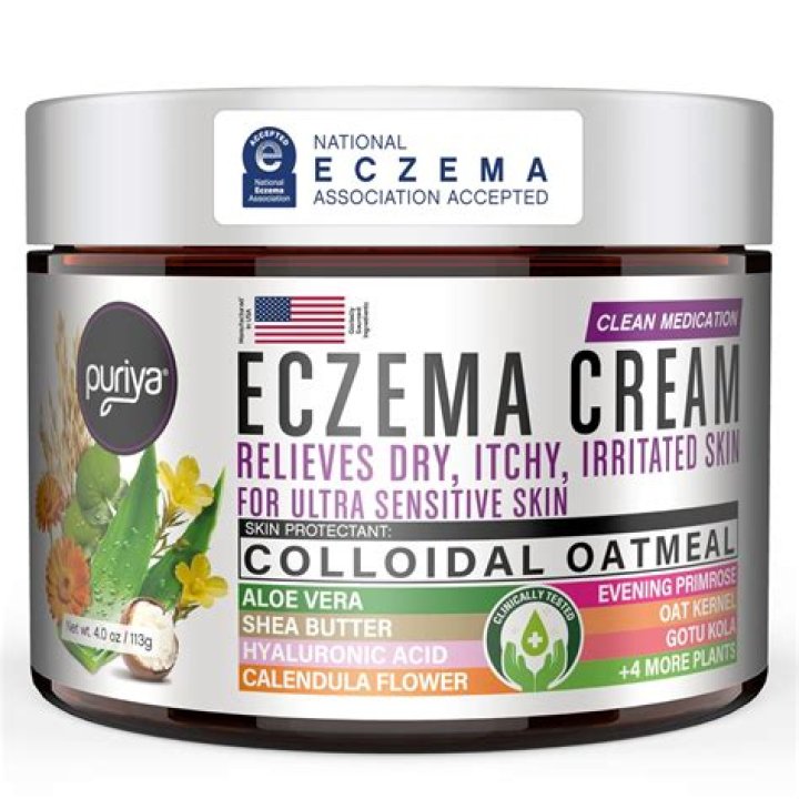 What is the best cream for facial eczema?
